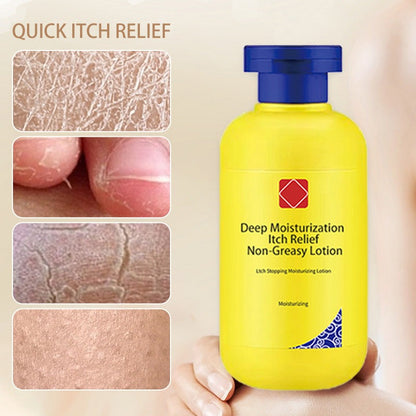Deep Hydrating Itch Relieving Non-Greasy Lotion | 🔥Buy 1 Get 1 Free🔥