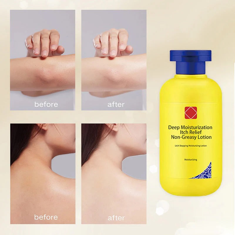 Deep Hydrating Itch Relieving Non-Greasy Lotion | 🔥Buy 1 Get 1 Free🔥